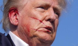 成年糖尿病患者使用大麻的人数正在上升