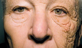 卡车司机的照片显示了28年的太阳晒伤是什么样子