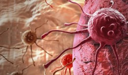 在线干预可以缓解痛苦，提高癌症患者的生活质量